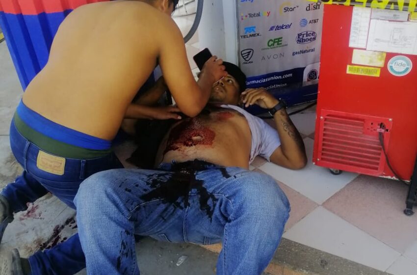  Atacan a balazos a un masculino en Cosolescaque