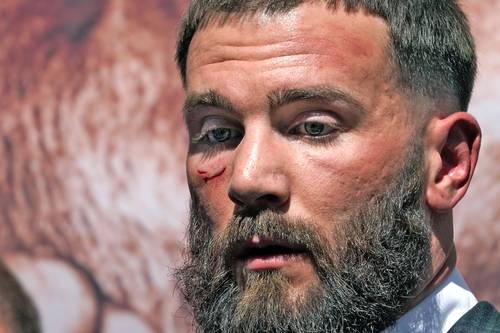  “Canelo mandará a Plant al hospital o al retiro”