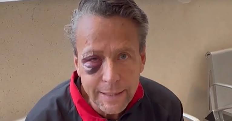  «Tengo el 30% de pérdida del ojo»: Alfredo Adame tras golpiza